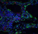 ORAI3 Antibody in Immunohistochemistry (IHC)