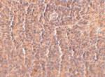 ORAI3 Antibody in Immunohistochemistry (IHC)