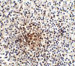 PD-1 Antibody in Immunohistochemistry (IHC)