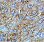 ABCA1 Antibody in Immunohistochemistry (Paraffin) (IHC (P))