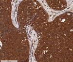 Cytokeratin 1 Antibody in Immunohistochemistry (Paraffin) (IHC (P))