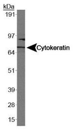 Cytokeratin 1 Antibody in Western Blot (WB)