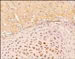 Tenascin C Antibody in Immunohistochemistry (Paraffin) (IHC (P))