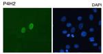 DUX4 Antibody in Immunocytochemistry (ICC/IF)