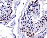 DUX4 Antibody in Immunohistochemistry (Paraffin) (IHC (P))