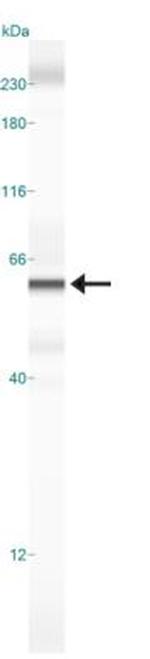 DUX4 Antibody in Western Blot (WB)