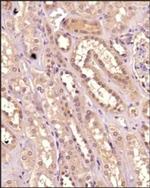 IKK alpha Antibody in Immunohistochemistry (Paraffin) (IHC (P))