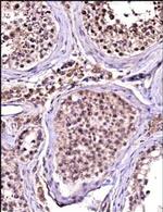 TBK1 Antibody in Immunohistochemistry (Paraffin) (IHC (P))