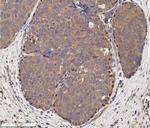 p73 Antibody in Immunohistochemistry (Paraffin) (IHC (P))