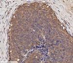 p73 Antibody in Immunohistochemistry (Paraffin) (IHC (P))