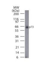 p73 Antibody in Western Blot (WB)