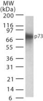 p73 Antibody in Western Blot (WB)