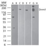 DNMT1 Antibody in Western Blot (WB)