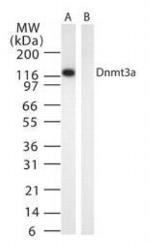 DNMT3A Antibody in Western Blot (WB)