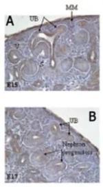 p73 delta Antibody in Immunohistochemistry (Frozen) (IHC (F))