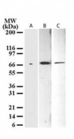 p73 delta Antibody in Western Blot (WB)