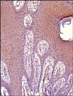 MiTF Antibody in Immunohistochemistry (Paraffin) (IHC (P))