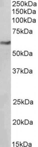 MiTF Antibody in Western Blot (WB)