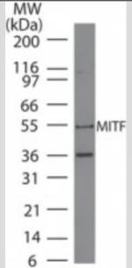 MiTF Antibody in Western Blot (WB)