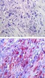 TLR4 Antibody in Immunohistochemistry (Paraffin) (IHC (P))