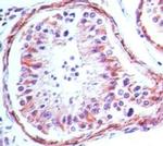 TLR4 Antibody in Immunohistochemistry (Paraffin) (IHC (P))