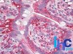 AGR2 Antibody in Immunohistochemistry (Paraffin) (IHC (P))