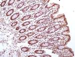 HMGB1 Antibody in Immunohistochemistry (Paraffin) (IHC (P))