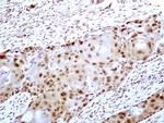 HMGB1 Antibody in Immunohistochemistry (Paraffin) (IHC (P))