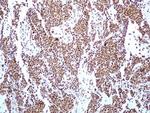 HMGB1 Antibody in Immunohistochemistry (Paraffin) (IHC (P))