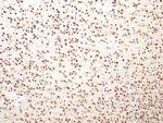 HMGB1 Antibody in Immunohistochemistry (Paraffin) (IHC (P))