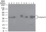 Podoplanin Antibody in Western Blot (WB)