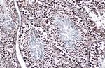 TET1 Antibody in Immunohistochemistry (Paraffin) (IHC (P))