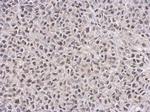 TET1 Antibody in Immunohistochemistry (Paraffin) (IHC (P))