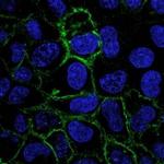 Carbonic Anhydrase IX Antibody in Immunocytochemistry (ICC/IF)