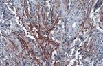 Carbonic Anhydrase IX Antibody in Immunohistochemistry (Paraffin) (IHC (P))