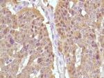 Calcitonin Antibody in Immunohistochemistry (Paraffin) (IHC (P))