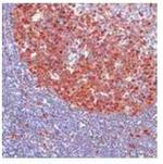 CDK2 Antibody in Immunohistochemistry (Paraffin) (IHC (P))