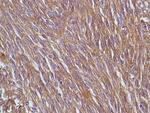 DOG-1 Antibody in Immunohistochemistry (Paraffin) (IHC (P))