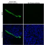 Cytokeratin 5 Antibody in Immunohistochemistry (Paraffin) (IHC (P))