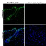 Cytokeratin 5 Antibody in Immunohistochemistry (Paraffin) (IHC (P))