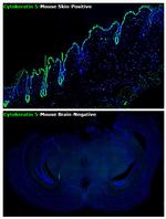 Cytokeratin 5 Antibody