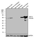 Cytokeratin 5 Antibody in Western Blot (WB)