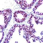 Progesterone Receptor Antibody in Immunohistochemistry (Paraffin) (IHC (P))