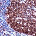 Stathmin 1 Antibody in Immunohistochemistry (Paraffin) (IHC (P))