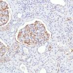 Nestin Antibody in Immunohistochemistry (Paraffin) (IHC (P))