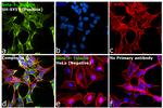 Mouse IgG2a (Heavy chain) Secondary Antibody in Immunocytochemistry (ICC/IF)