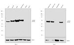 ALDH2 Antibody in Western Blot (WB)