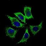 ALDH2 Antibody in Immunocytochemistry (ICC/IF)