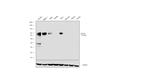 CD105 Antibody in Western Blot (WB)