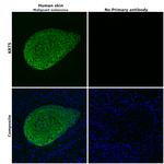 Cytokeratin 5 Antibody in Immunohistochemistry (Paraffin) (IHC (P))